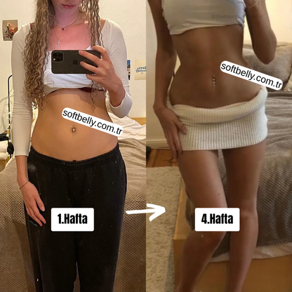 Agraflı Sıkılaştırıcı Kum Saati Korsesi