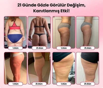 Bacak İnceltme Selülit Giderme, Ödem Atma, Sıkılaştırma Masaj Aleti